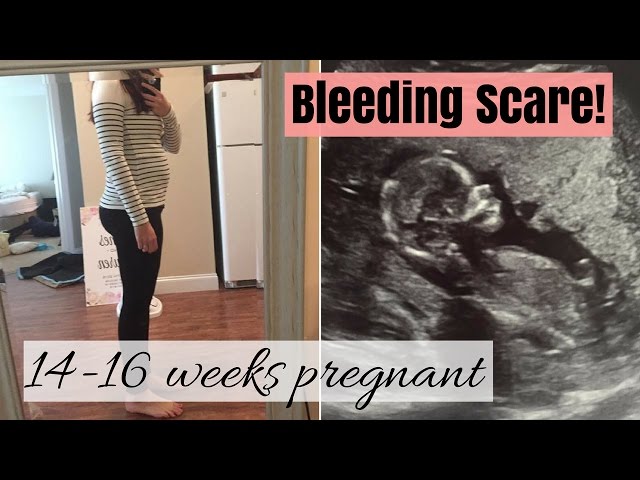 14-16 weeks pregnant- BLEEDING SCARE- SCH