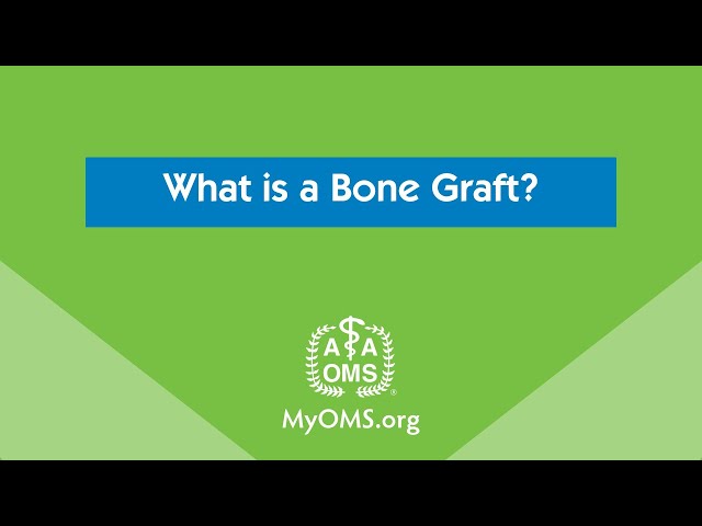What is a Bone Graft?