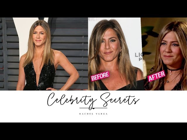 Celebrity Plastic Surgery Jennifer Aniston (Expert Injector Insight!)