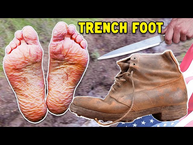 (106 yr old) Why this boot caused 75,000 casualties in WW1