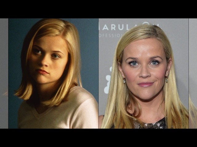 Reese Witherspoon Celebrity Plastic Surgery review with Rachel Varga