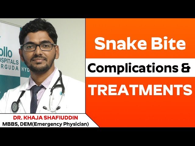 Snake Bites: Precautions and Treatment | Emergency Physician - Dr. Khaja Shafiuddin