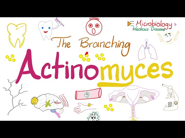 Actinomyces israeli - Branching Bacteria - Microbiology & Infectious Diseases