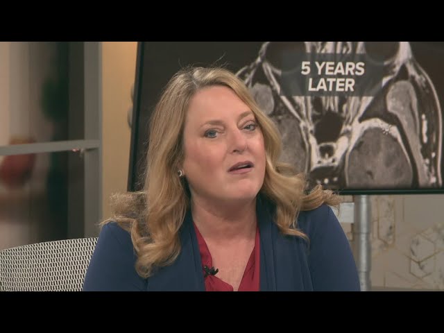 3News' Monica Robins reflects on 5 years since brain tumor diagnosis