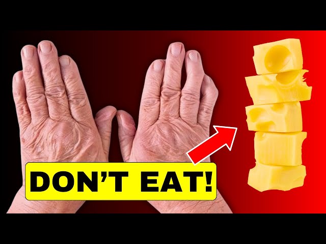 STOP NOW! 7 Most Dangerous Foods for Arthritis You Must Avoid || HealthQuest