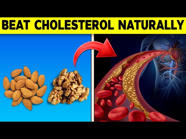 How To Reduce Cholesterol Naturally And Get Off Statins!