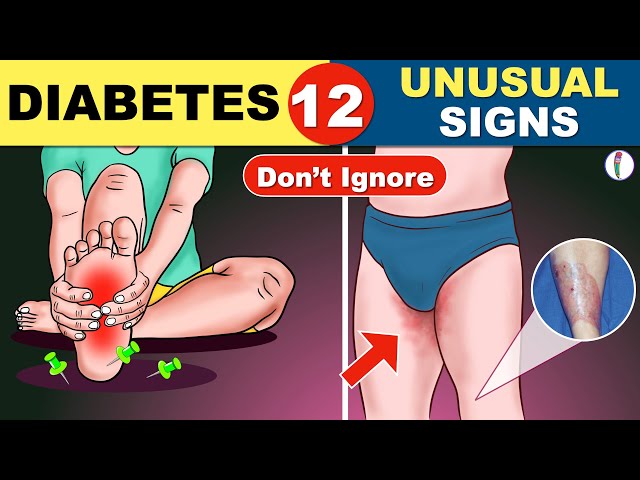 12 Unusual Symptoms of Diabetes | Diabetes Symptoms | Diabetes Mellitus |  | Diabetes Warning Signs