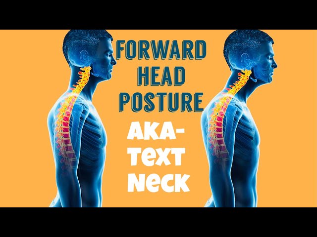 Forward Head (aka Text Neck )
