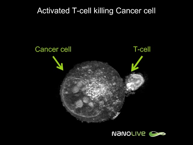 Label-free Live Cell Imaging: Activated T-Cell Killing Cancer Cell