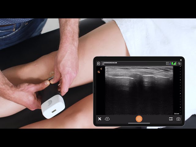 How to Scan the Knee - Ultrasound Scanning Technique