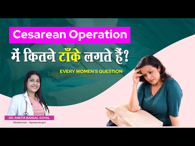 Worried about Cesarean Operation stitches? Dr. Ankita Bansal Goyal