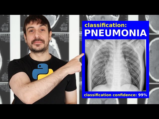 Image classification WEB APP with Python and Streamlit | Pneumonia classifier | Computer vision