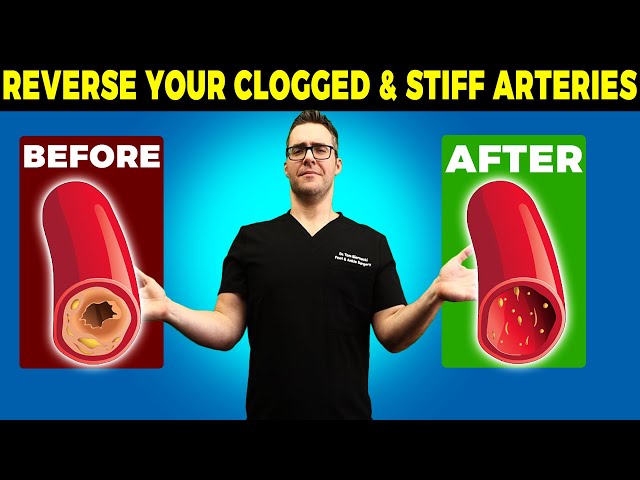 🔄REVERSE Your Clogged & Stiff Arteries [50% Atherosclerosis over 45!]