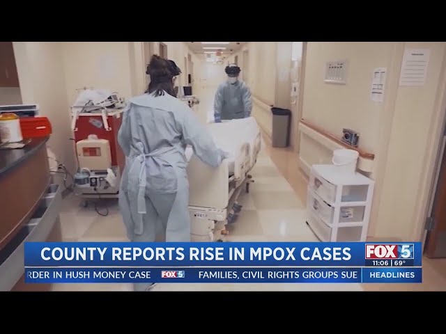 San Diego County records rise in Mpox cases