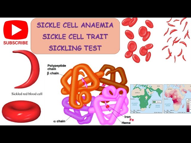 Sickle Cell Anaemia II Sickle Cell Trait II Sickling Test || #pathogenesis ll #barman_sir