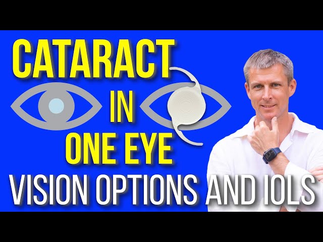 IOL for cataract in one eye only