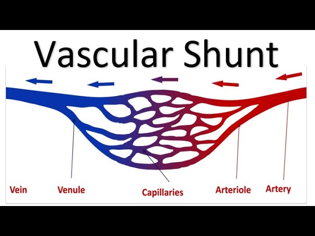 OCR A Level PE - Vascular Shunt