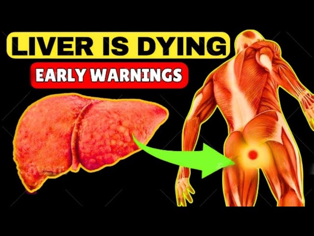 6 Weird Signs That You Have Liver Damage