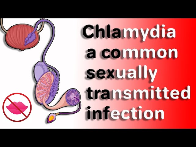 Chlamydia in Men: Causes, Symptoms, Treatment & Prevention | Allopathic & Homeopathic Approaches