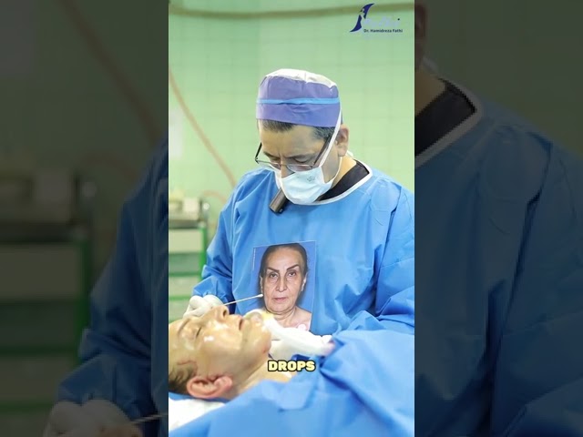 جراحی لیفت صورت و گردن برای مراجعه کننده عزیز