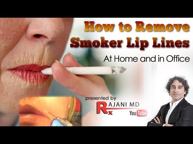 How to Treat Smokers Lip Lines At Home and in The Office Solutions