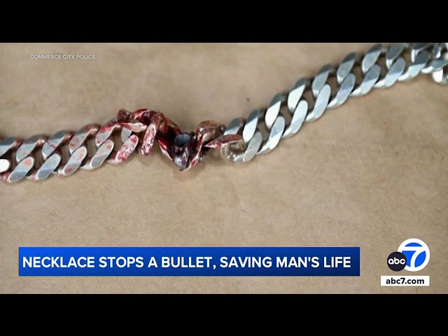 Man literally dodges bullet thanks to his chain necklace: 'Just incredible'