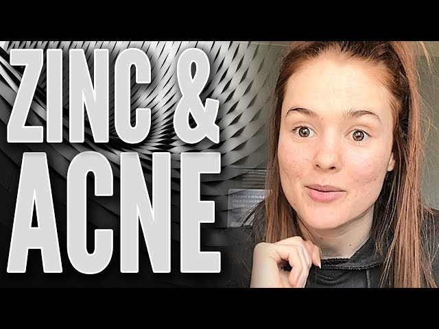 Why Everyone With Acne Should Try Zinc - Natural Treatment for Acne!