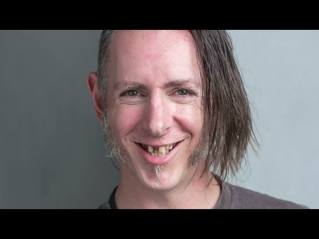 Tom's Transformative Smile Journey: All-on-X Dental Implants & Sobriety | A Second Chance