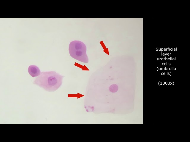 INTERPRETATION OF URINE CYTOLOGY. Atlas and tutorial for cytotechnologist learning