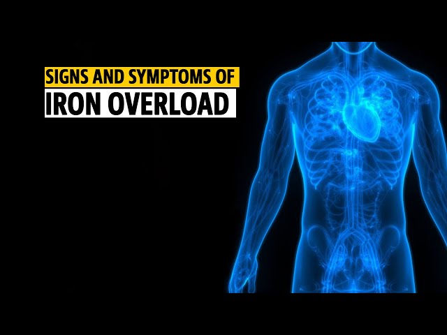 Signs and Symptoms Of Iron Overload In Your Body