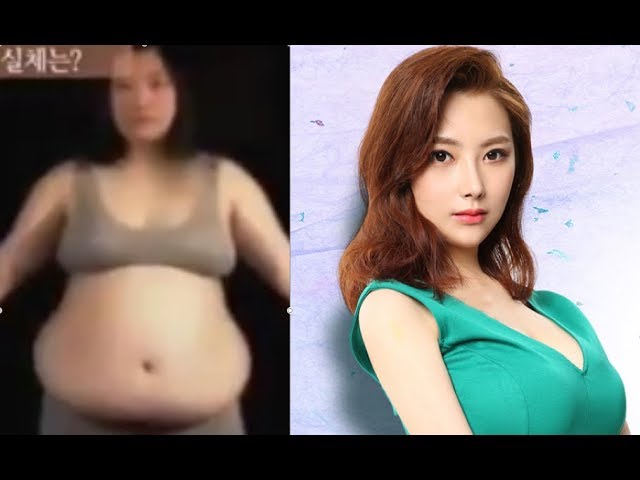 View Plastic Surgery LET ME IN make over (Korean Plastic Surgery Before & After)
