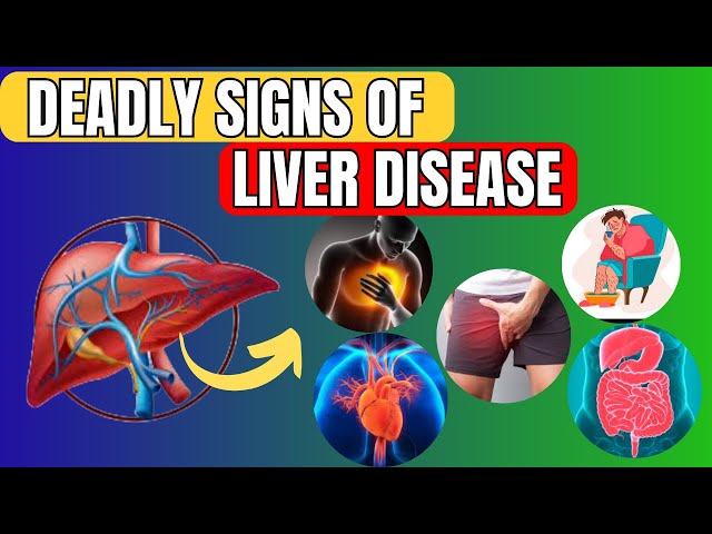 9 PROVEN DEADLY AND OBVIOUS SIGNS OF LIVER DISEASE THAT YOU SHOULD NEVER IGNORE(LIVER is DYING! )