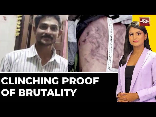Renukaswamy Murder Probe Intensifies, Gruesome Details Emerge In Sandalwood Case | India Today