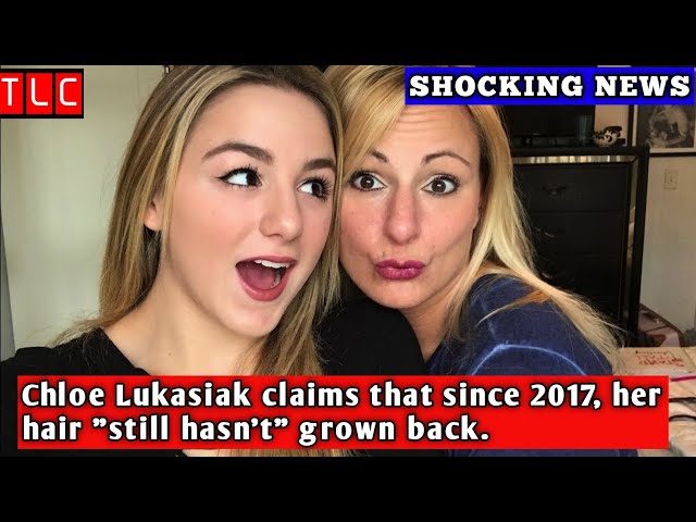 Chloe Lukasiak claims that since 2017, her hair "still hasn't" grown back. I Dance Moms I Tlc