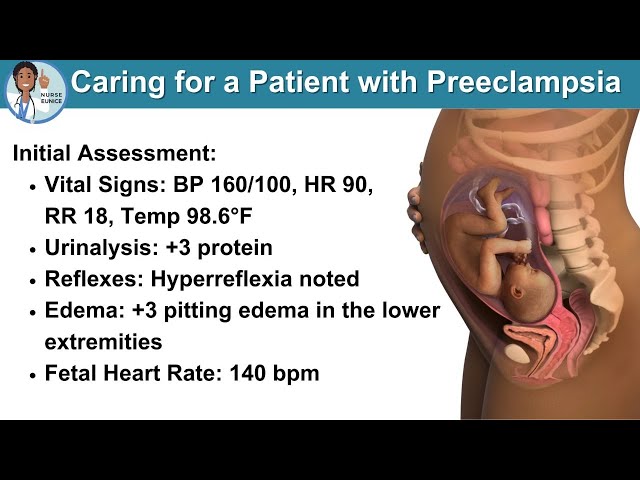 CNA & PCT Practice Test - Caring for a Patient with Preeclampsia🤰
