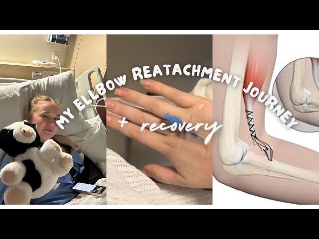 MY ELLBOW REATTACHMENT SURGERY + recovery (a very long and stressful documentary)