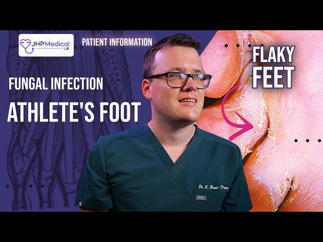 DOCTOR Explains ATHLETE'S FOOT | Fungal Foot Infection - Itchy Flaky Feet | Tinea Pedis