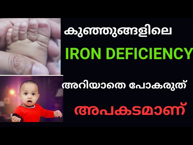 Iron deficiency in babies/how to prevent/symptoms/malayalam