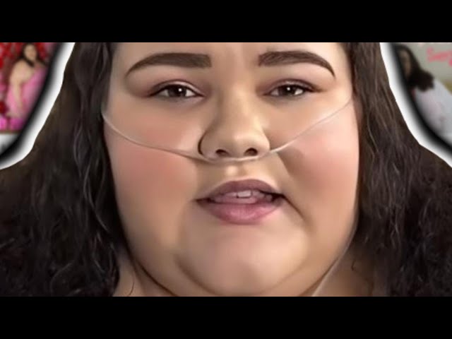 'Fat Acceptance' has gone too far