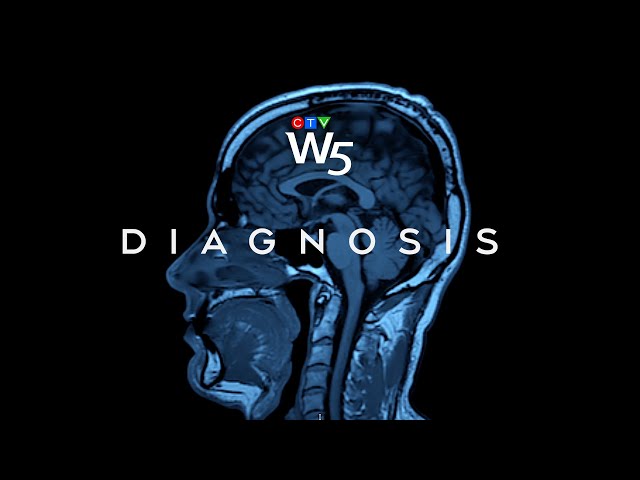 W5: A mysterious neurological syndrome grips New Brunswick