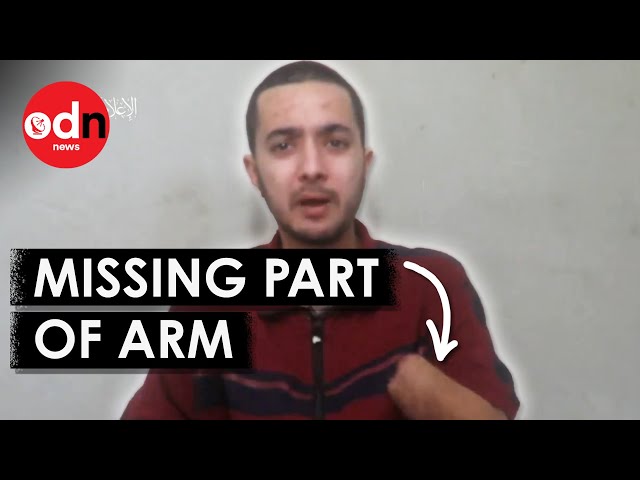 Hamas Release 'Proof of Life' Video of Hostage Who Lost Hand on October 7th