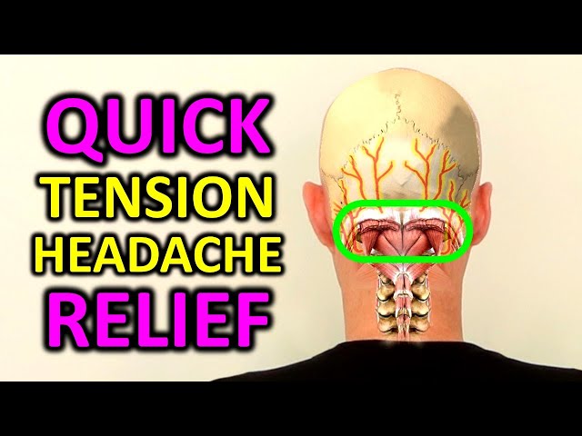 Tension Headache Exercises. Stress Headache Relief in 4 Minutes.