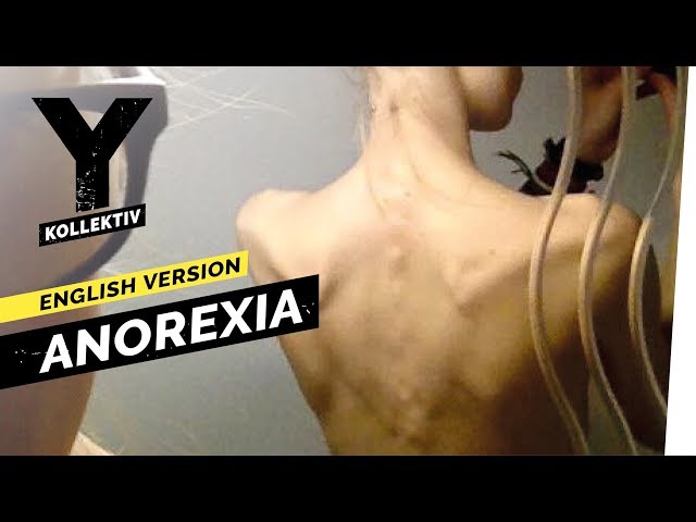 Anorexia – Weight-Loss Obsession I Y-Kollektiv English Version