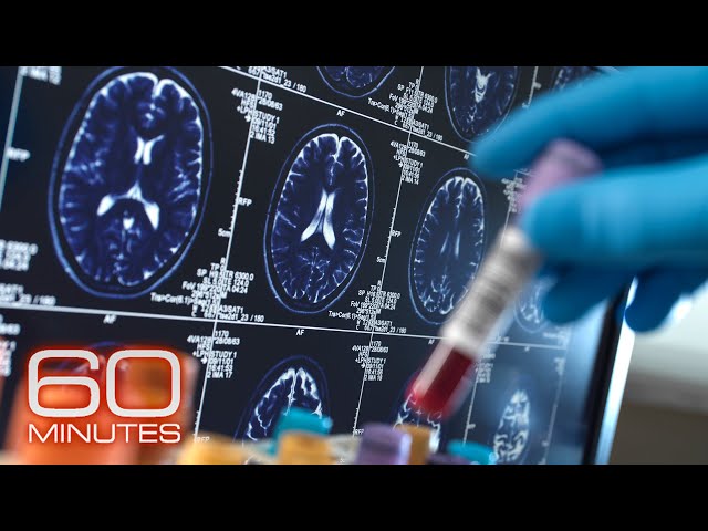 Alzheimer's and Dementia | 60 Minutes Full Episodes