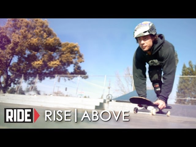 Skateboarder Buddy Elias Loses Leg Due To Smoking & Buerger's Desease - Rise Above (Pt 1)
