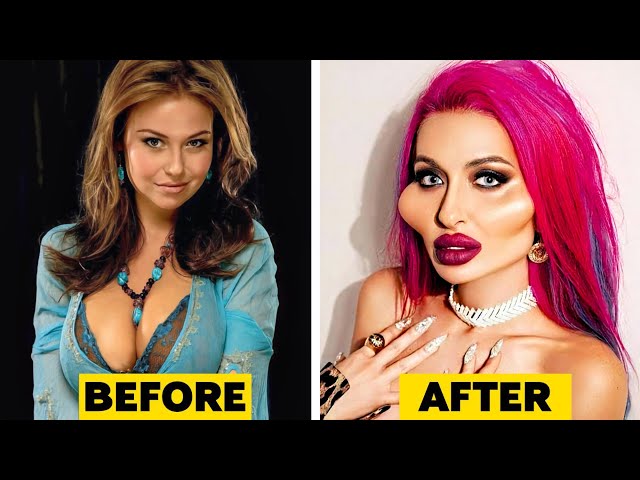 Celebrities Before and After Plastic Surgery