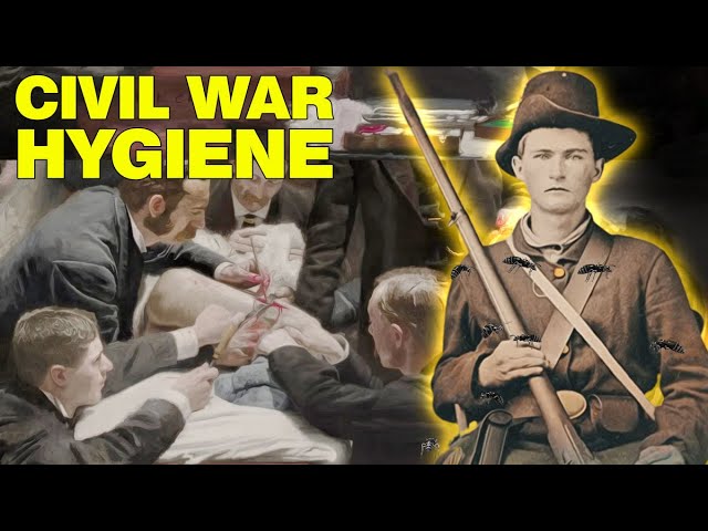 What Hygiene Was Like in the Civil War