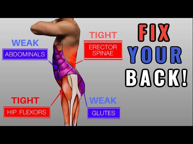 Fix "Anterior Pelvic Tilt" in 10 Minutes/Day (Daily Exercise Routine)