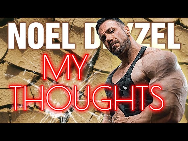 Noel Deyzel || MY THOUGHTS - Did Philion Get it Right?