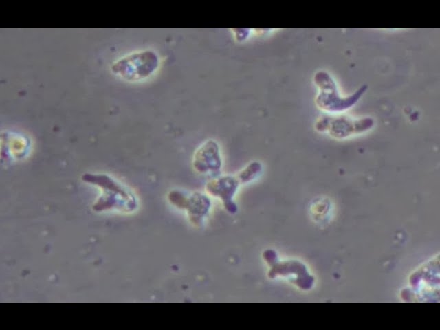 Naegleria fowleri under a microscope with increased speed.